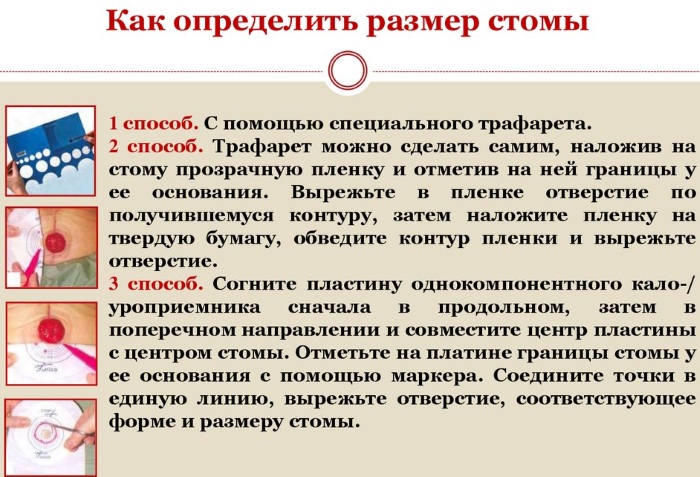 Диета После Колостомы