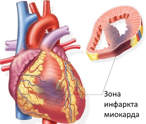 Рибоксин. Инструкция, показания к применению внутривенно, состав, противопоказания