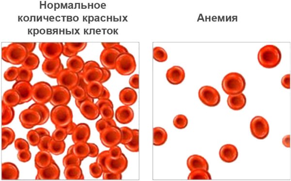 Повысить гемоглобин в крови: лекарства, полезные продукты, рецепты отваров