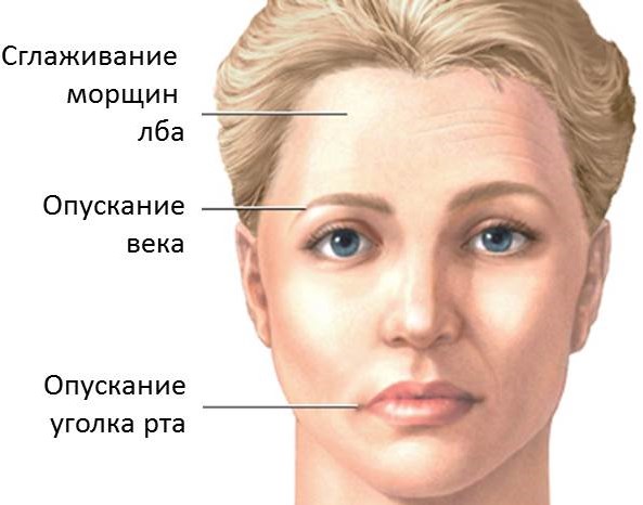 Правый глаз лежал в стакане остальное на диване