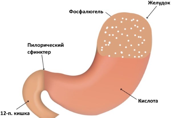 Список препаратов от изжоги. Инструкции, особенности применения, противопоказания, цены