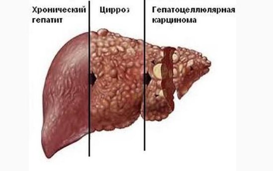 Налет на языке желто зеленого цвета. Причины, способы устранения