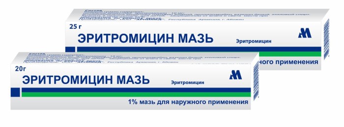 Бактериальный конъюнктивит глаз. Симптомы, лечение у детей, капли