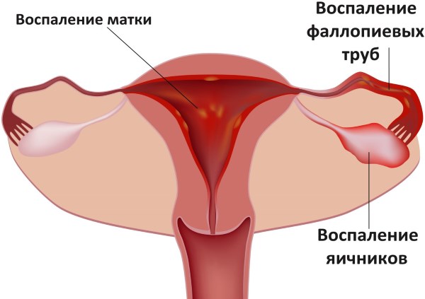 Цикл месячных: норма дней у женщин. Какой цикл считается нормальным