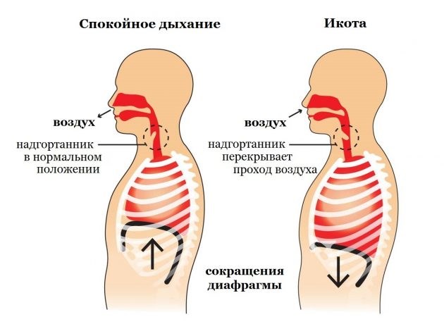 Икота у взрослого. Как быстро избавиться в домашних условиях. Таблетки, народные методы