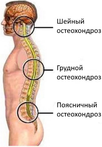 Индометациновая мазь. Инструкция по применению, от чего помогает при беременности, цена, отзывы