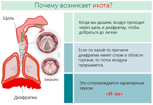 Как убрать икоту у взрослого дома. Народные методы, медикаментозное лечение, таблетки