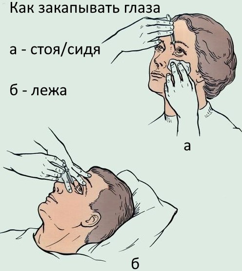 Операция по удалению катаракты. Сколько длится послеоперационный период, осложнения