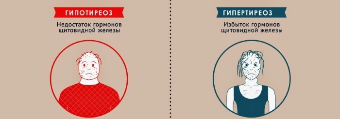 Щитовидная железа у женщин. Лечение лекарствами, народные средства, лапчатка, эндонорм