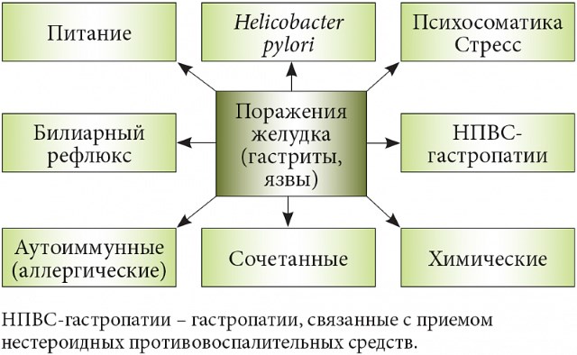 Симптомы язвы желудка на ранней стадии у женщин, мужчин, детей