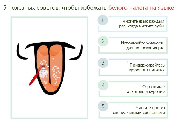 Фото языка с белым налетом