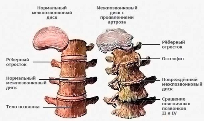 Боль в пояснице – причины и лечение