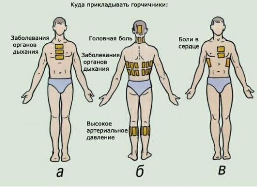 Как ставить горчичники при кашле детям — инструкция по применению: при каких заболеваниях рекомендованы разогревающие процедуры, минимальный возраст для манипуляции, показания к применению и длительность прогревания