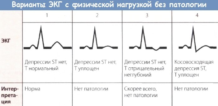 Что такое холтер сердца, как делают мониторинг, фото, видео, цена