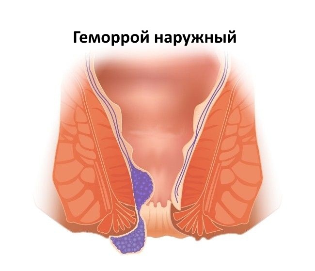 Левомиколевая мазь. Инструкция по применению