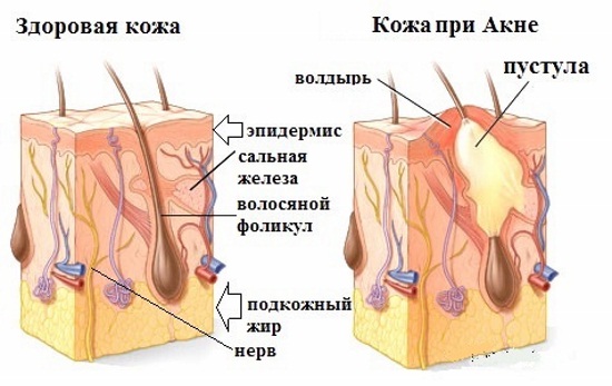 Левомиколевая мазь. Инструкция по применению