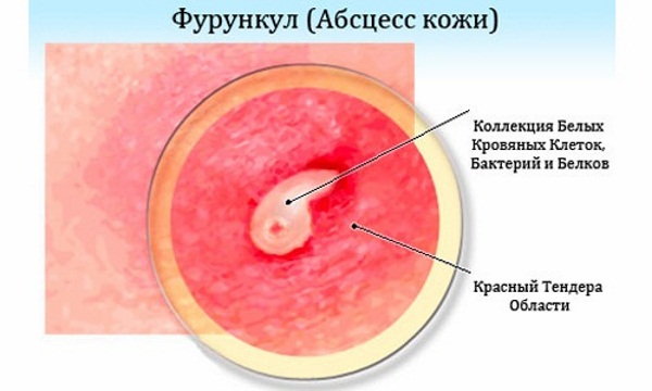 Левомиколевая мазь. Инструкция по применению