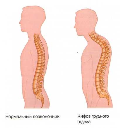 Вдовий горбик фото