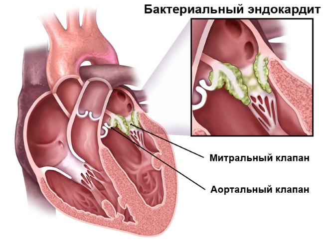 Крутит живот и болит слева под ребрами thumbnail