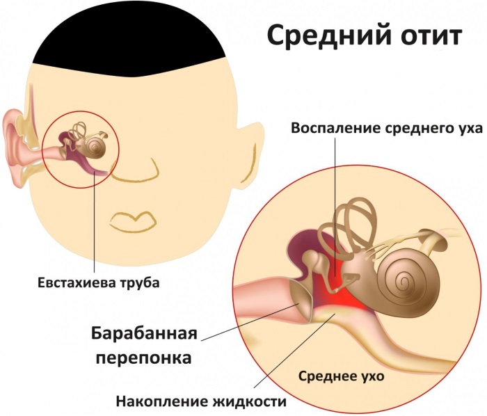 Боли в ухе у ребенка - что делать, чем лечить, первая помощь в домашних условиях. Капли