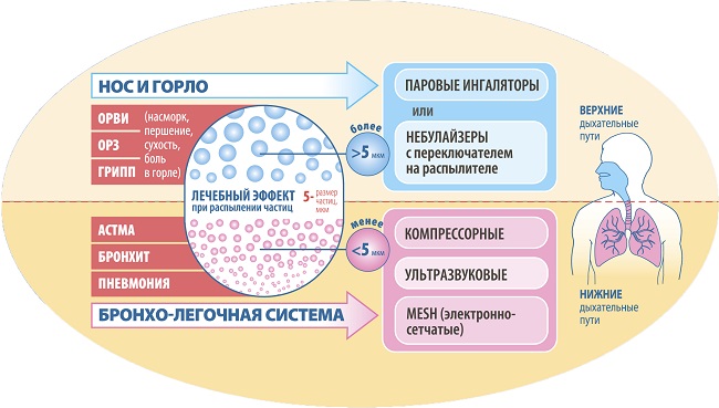 Ингаляции при кашле для детей небулайзером. Рецепты с амбробене, физраствором, Лазолваном, народными средствами