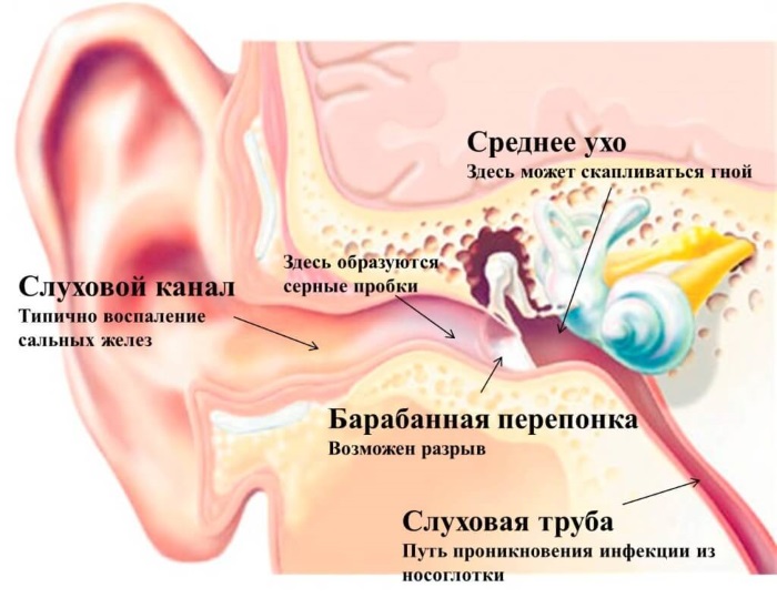 Золотуха за ушами у взрослых фото лечение