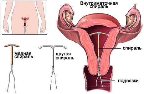 Противозачаточные таблетки и лучшие средства, чтобы не забеременеть. Какие есть, названия, инструкция применения