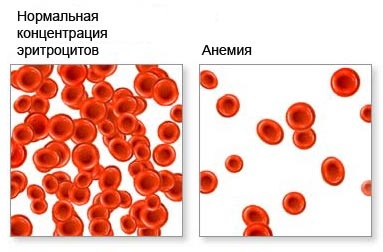 Фолиевая кислота: инструкция по применению, дозировка, противопоказания, цена