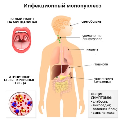 Как повысить иммунитет взрослому, ребенку - витамины, продукты, лекарства, народные средства