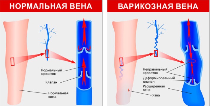 Мази при дерматите атопическом, себорейном, аллергическом, контактном у детей, взрослых. Причины и лечение