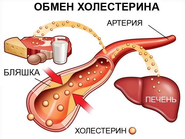 Таблица нормы холестерина по возрасту у женщин. Как нормализовать, понизить уровень холестерина в крови