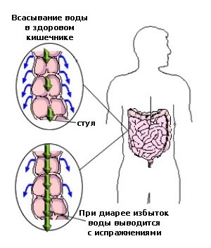 Что можно и нельзя есть при поносе взрослому человеку. Список продуктов