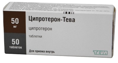 Андрогенная алопеция у женщин. Симптомы, причины, лечение, уход за волосами