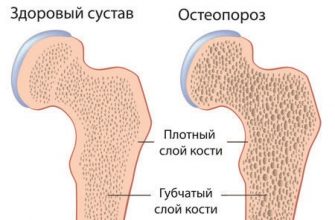 Боль в колене картинка