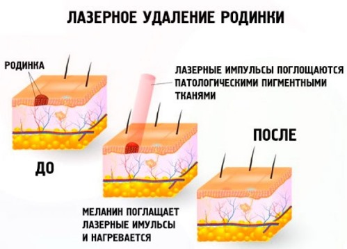 Красные точки на теле - что это, причины, как лечить у взрослых, беременных и детей