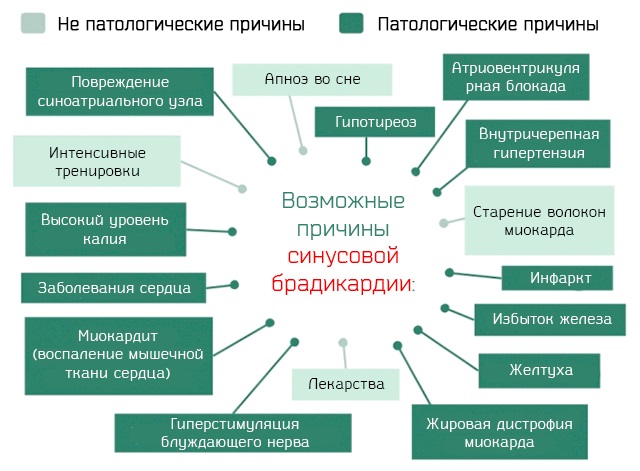 Пульс человека. Норма по возрасту в 20, 30-40, 50-60 лет, без нагрузки, при нагрузке. Как нормализовать пульс при сбоях