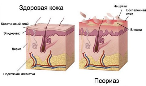 Антибактериальные мази для кожи лица, интимной зоны, ног, рук, головы, при дерматите для детей и взрослых. Список