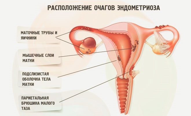 Антимюллеров гормон - что это такое, норма у женщин, таблица по возрасту, как правильно сдавать анализ, на какой день цикла, что делать, если повышен или понижен