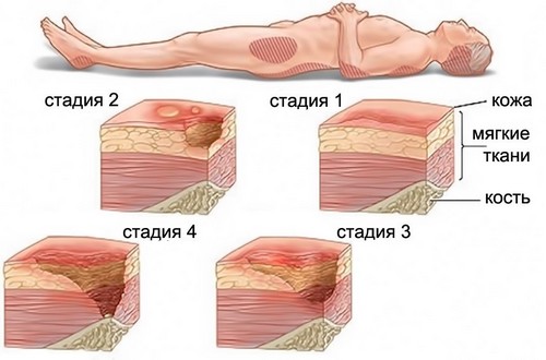 Камфорное масло для взрослых и детей. Применение при отите в ухо, кашле, в период беременности и лактации