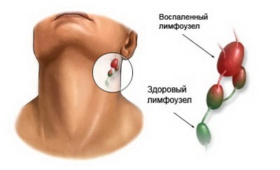 Камфорное масло для взрослых и детей. Применение при отите в ухо, кашле, в период беременности и лактации