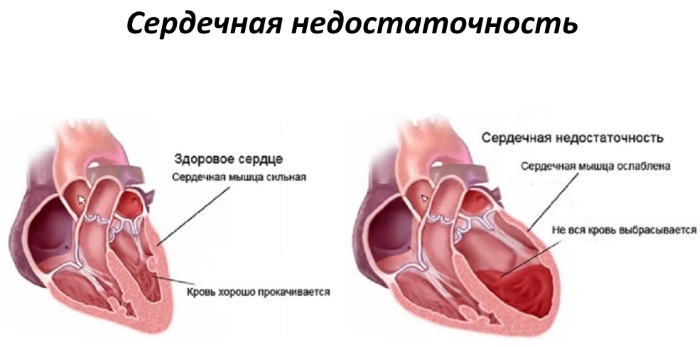 Компресс из соли от кашля, для суставов взрослым