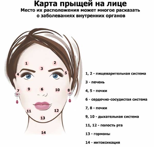 Сыпь на теле у взрослого. Что это может быть, если чешется, мелкая в виде прыщиков, крупная с покраснениями. Фото и как лечить