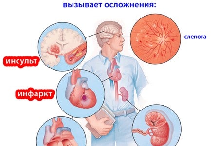 Как повысить тестостерон у мужчин естественными способами, народными средствами, препараты в аптеке, норма гормона в зависимости от возраста