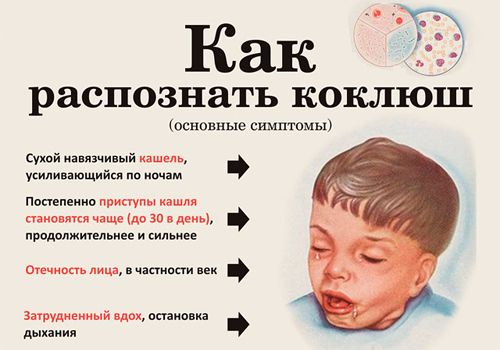 Коклюш у детей - симптомы и лечение, фото, как определить, лечить ребенка народными средствами, антибиотиками. Последствия и профилактика