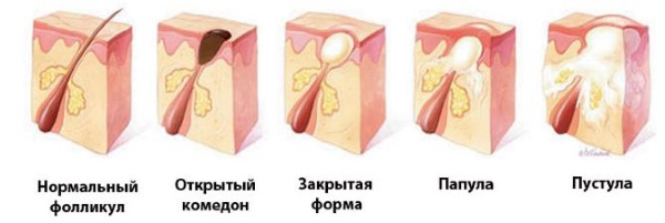 Красные пятна на лице у ребенка, новорожденного. Фото, причины возникновения, чем лечить