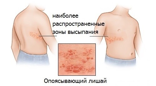 Красные пятна на лице у ребенка, новорожденного. Фото, причины возникновения, чем лечить