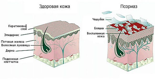 Лишай у человека. Симптомы, признаки и лечение. Как выглядит лишай. Фото, виды, стадии с названиями