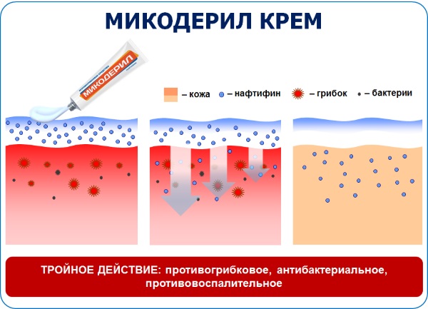 Микодерил – средство от грибка ногтей. Инструкция по применению, цена, отзывы, аналоги