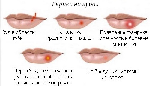 Отек лица. Причины у женщин по утрам, перед месячными, при гормональном сбое, нарушении эндокринной системы. Анализы и лечение