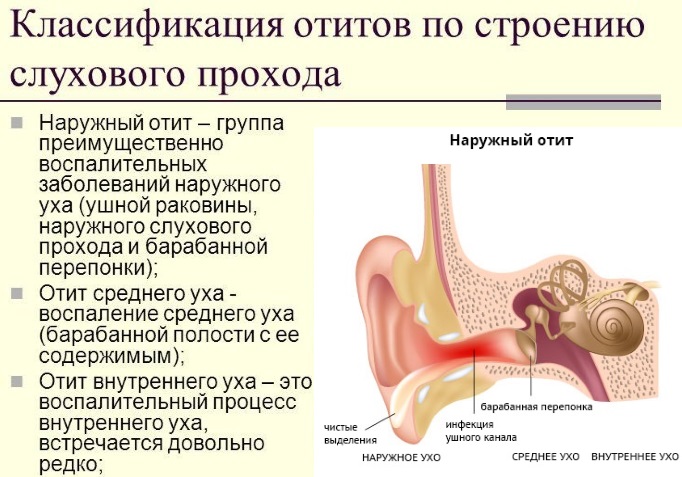 Отит у ребенка - симптомы и лечение в домашних условиях. Препараты, народные средства, лечение по Комаровскому